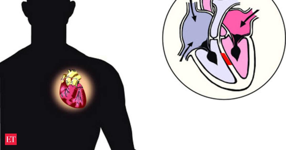 Economic Times article image for Dr. Godbole’s feature on exercising the heart